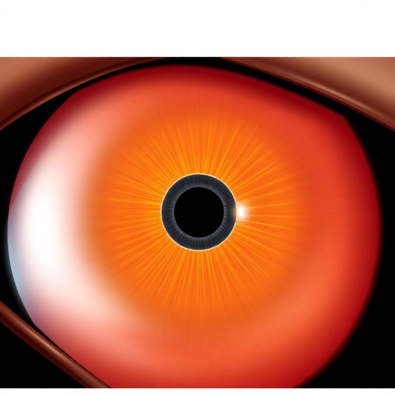 Foro maculare a tutto spessore visibile in sezione OCT — indicazione classica alla vitrectomia con peeling