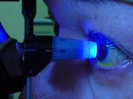 Tonometria: misurazione della pressione intraoculare con strumento ottico
